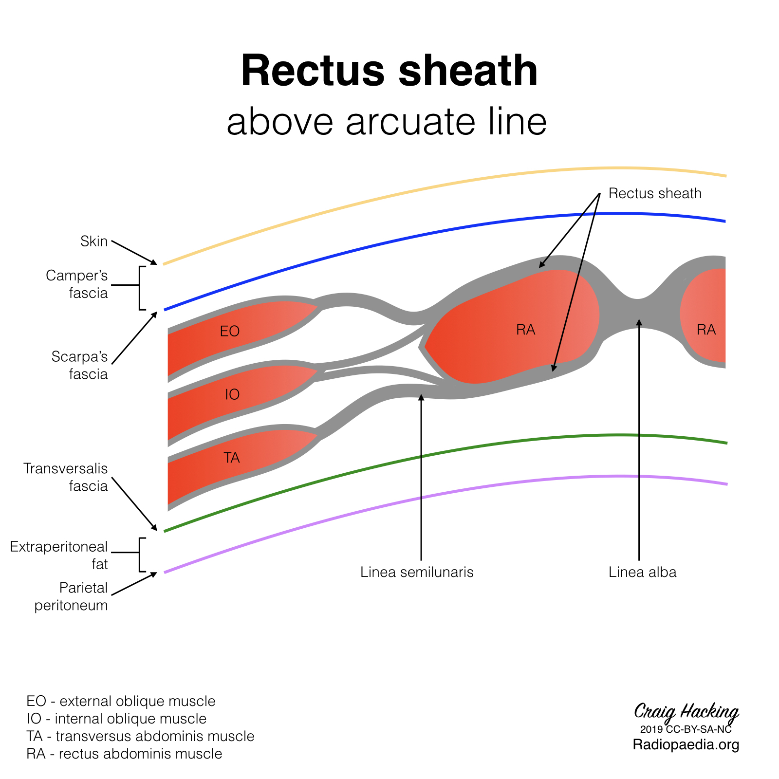 Radiopaedia Drawing Rectus Sheath Above Arcuate Line English Labels